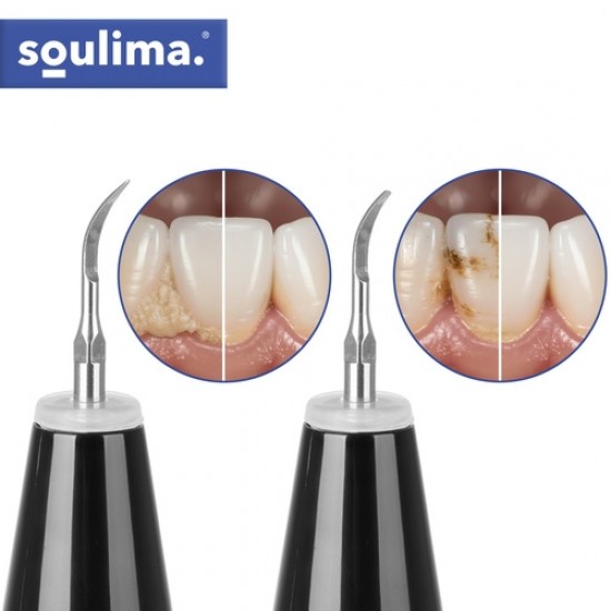 Υπερηχητικός Καθαριστής Δοντιών Soulima για Αφαίρεση Πέτρας και Πλάκας 13-25746